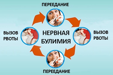 Лечение булимии в Лоо